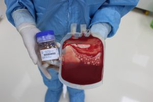 Tìm hiểu về tác dụng của Tế bào gốc máu dây rốn
