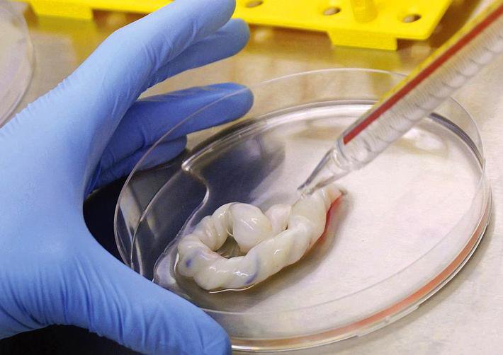 Lưu trữ Tế bào gốc dây rốn chữa được những bệnh gì?
