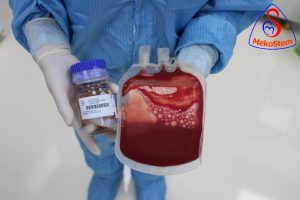 Lưu trữ tế bào gốc máu dây rốn và lưu trữ tế bào gốc màng dây rốn 