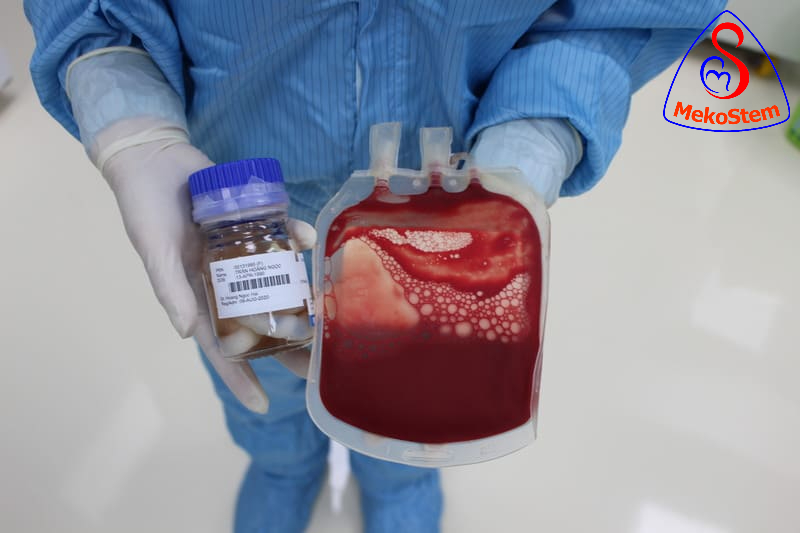 Chi phí Lưu trữ tế bào gốc máu dây rốn và lưu trữ tế bào gốc màng dây rốn