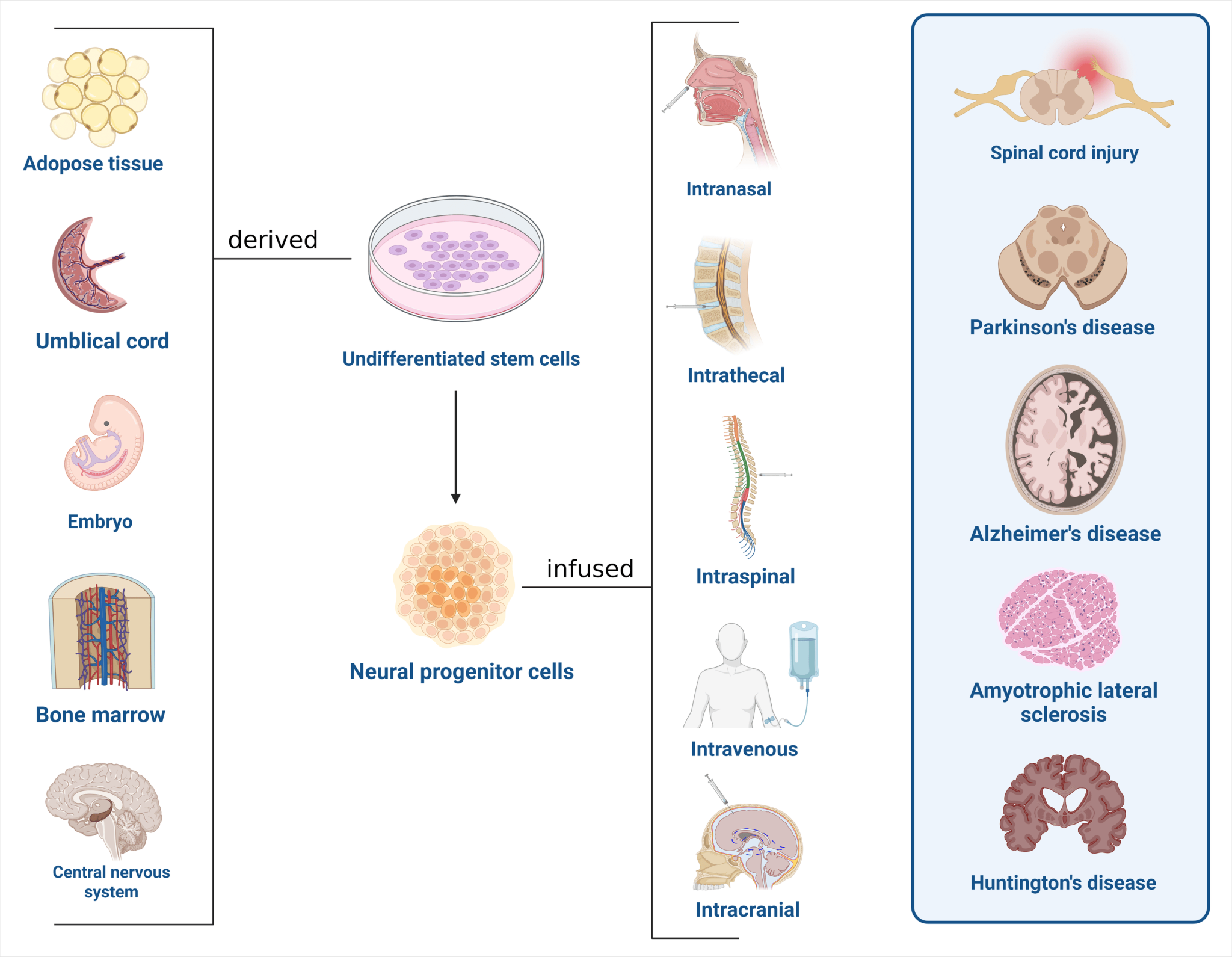 Exploring the Emerging Role of Stem Cell Therapy in Neurodegenerative ...
